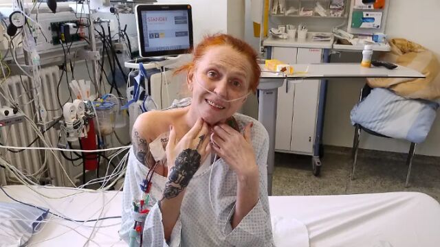 Снимка: Жена живее близо година със специално изкуствено сърце. Издъхва след отравяне на кръвта