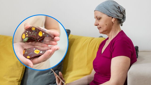 Снимка: Диета при рак на черния дроб: Какво да ядем, когато нямаме апетит?