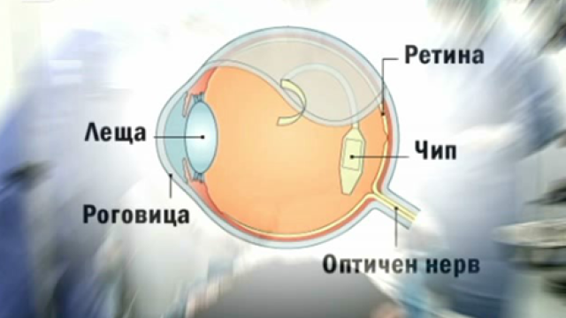 Снимка: Учени имплантираха нов вид чип в ретината на незрящи