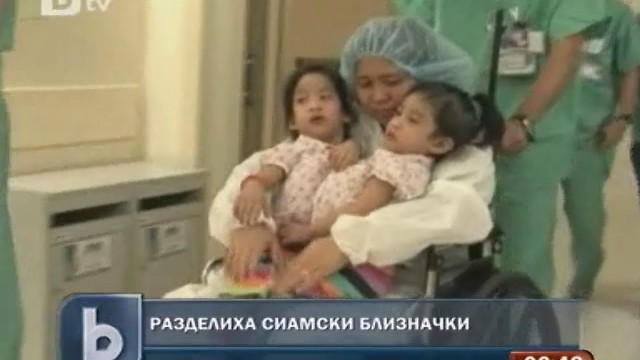 Снимка: Разделиха сиамски близначки с общ черен дроб 