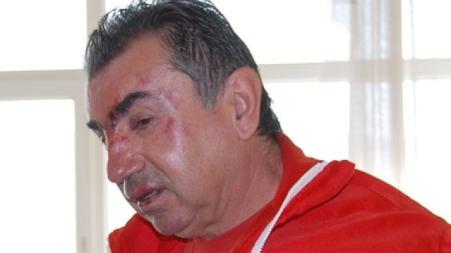 Снимка: Започва делото срещу нападателя на фелдшер от Шумен
