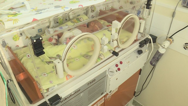 Снимка: Малки бойци: Най-преждевременно родените близнаци във Великобритания ще оцелеят