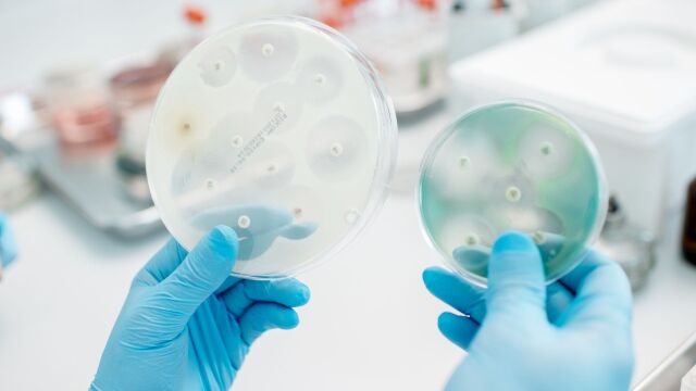 Снимка: Инфекции, устойчиви на антибиотици, ще нараснат с 60% до 2030 г.