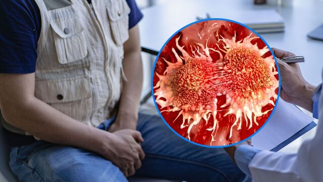 Снимка: Рак на тестисите: Най-лечимият рак, без симптоми