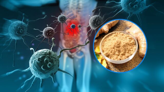 Снимка: Зимна подправка регулира кръвната захар и защитава от рак