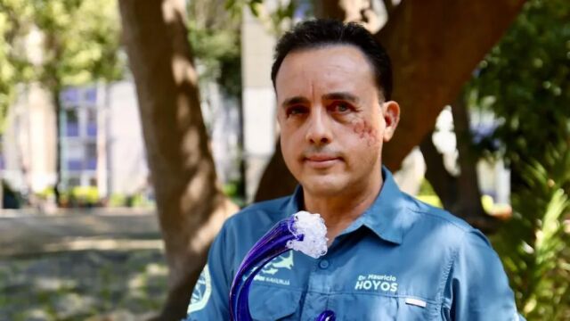 Снимка: „Това животно ми пощади живота“: Биолог, ухапан от акула, се надява да я срещне отново
