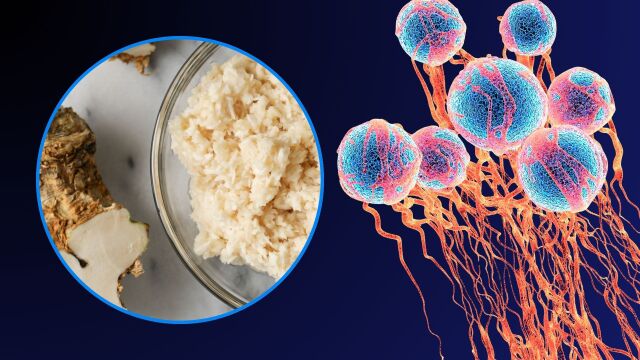 Снимка: Популярна подправка може да помогне в борбата с рака