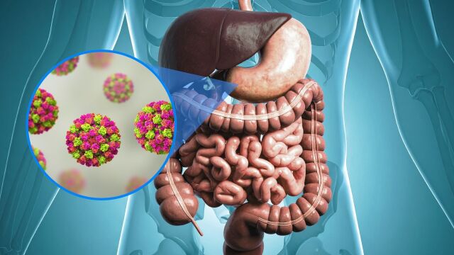 Снимка: Норовирус: Истината за „стомашния грип“, която всеки родител трябва да знае