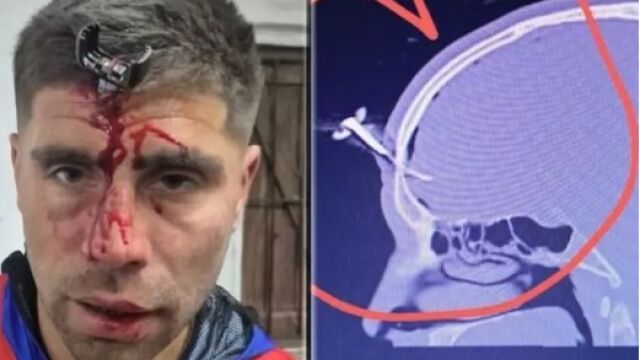 Снимка: 12 часа ужас: Бивш футболист оцеля след атака с гаечен ключ в главата