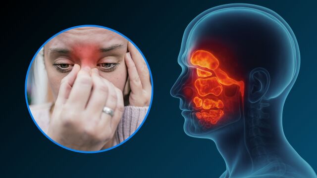 Снимка: Отслабването помага при хронични проблеми със синусите