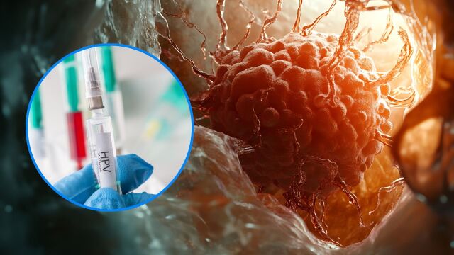 Снимка: Ваксина заличава рака: Европейски страни с нито един случай на рак при ваксинираните