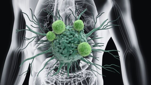 Снимка: Какво храни рака: Метаболизъм срещу генетика
