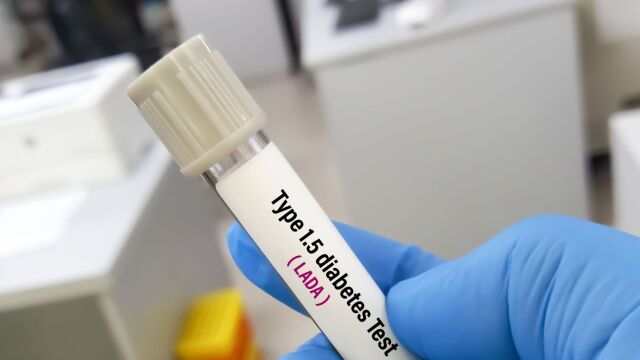 Снимка: Какво означава диабет тип 1.5: Защо често остава скрит