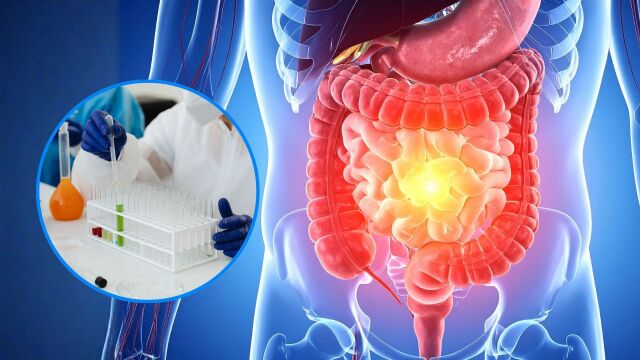 Снимка: Опасни химикали застрашават здравето на червата: Кои са те?