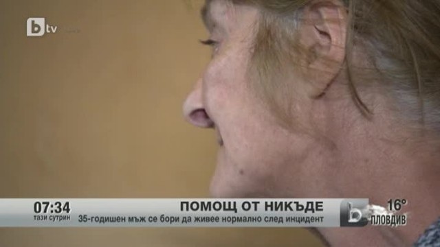 Снимка: 35-годишен мъж се бори да живее нормално след инцидент