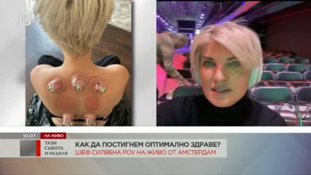 Снимка:  Говори шеф Силвена Роу: Какви са последните тенденции в подмладяването?