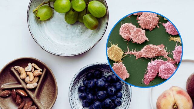 Снимка: 6 плода, които борят раковите възпаления в тялото