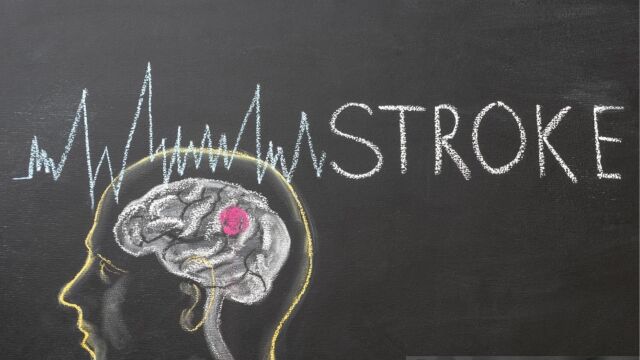 Снимка: Риск от повторен инсулт: Как да се предпазим