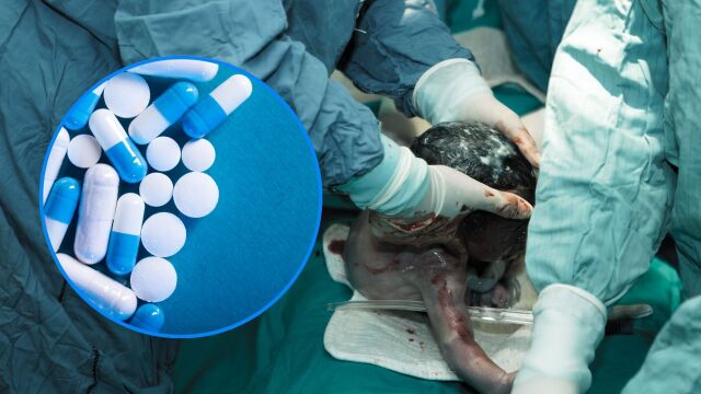 Снимка: Антибиотици намаляват риска от усложнения след раждане