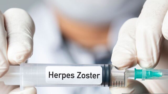 Снимка: Ваксината срещу херпес зостер намалява риска от деменция с над 50%