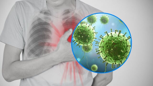Снимка: Грипът, COVID-19 и други вируси увеличават риска от инфаркт и инсулт