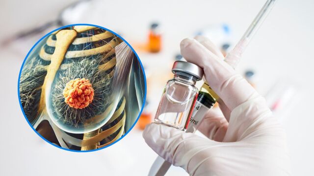 Снимка: Колко близо сме до ваксина срещу рака на гърдата?