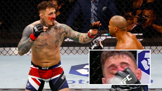 Снимка: „Мускулите на окото не работят“: Световният шампион на UFC Том Аспинал „все още не вижда“ с дясното си око след бъркането