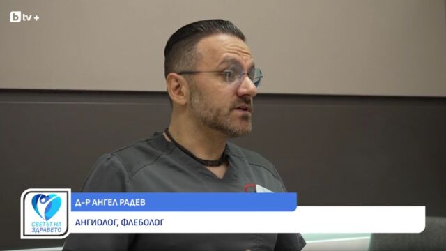 Снимка: Д-р Ангел Радев: Кога тежестта и отоците в краката са венозен проблем (ВИДЕО)