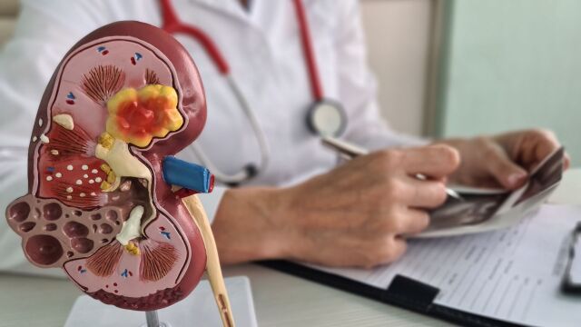 Снимка: 5 причини, че бъбреците не функционират правилно според нефролог