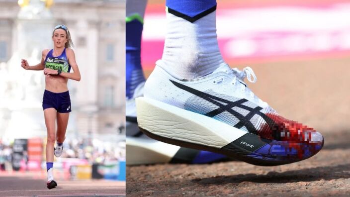 Тежки кадри от маратона на Лондон. Кракът на участничка експлодира! (ВИДЕО)