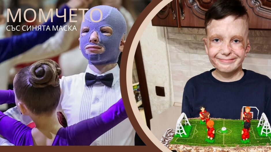 Роман, на 11 г. - полуизгорял, с шрапнел в черепа, без майка, но с мечти! (СНИМКИ)