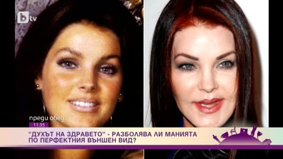 Kога се пристрастяваме към естетичните и пластичните корекции и болест ли е желанието да си красив?