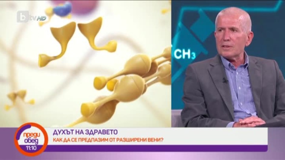 "Духът на здравето": Как да се предпазим от разширени вени?