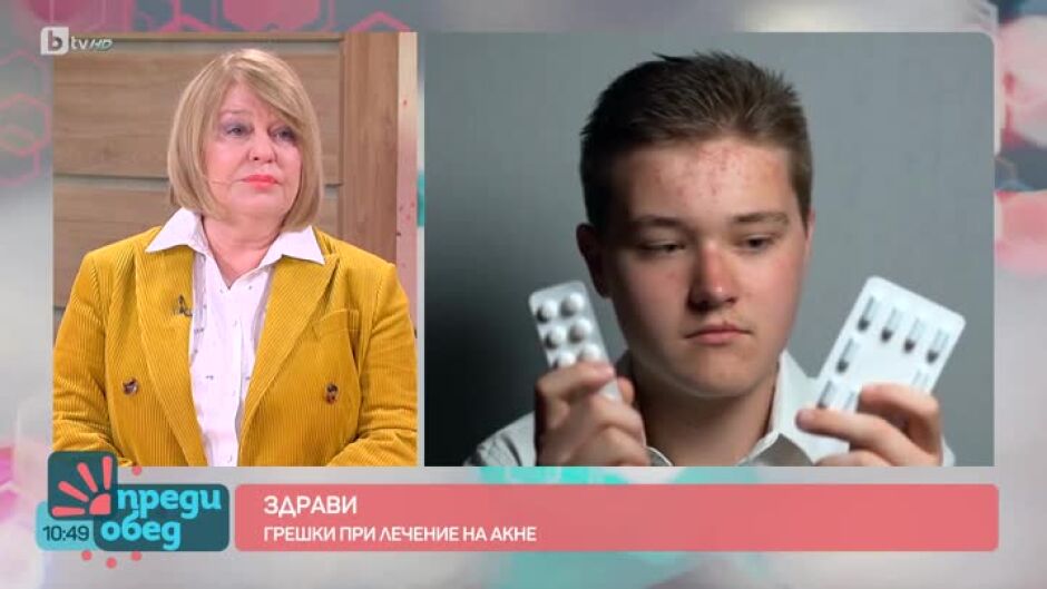 "Здрави": Как с правилна терапия да контролираме акнето?
