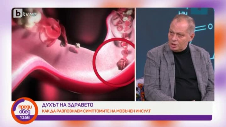 "Духът на здравето": Как да разпознаем симптомите на мозъчен инсулт?