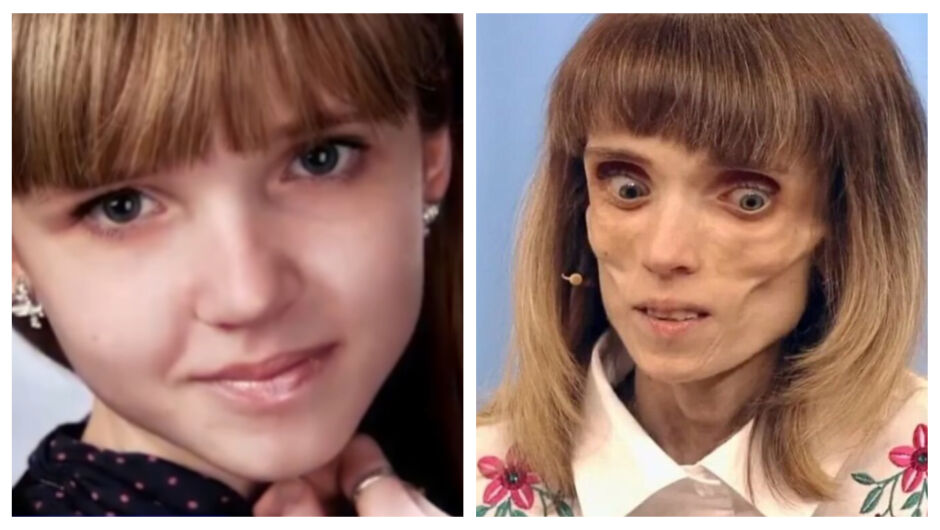 Историята на Кристина, която стига до 17 килограма в стремеж към „съвършенство“