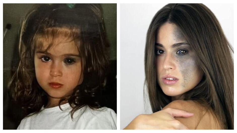 Момичето с различно лице, което вече не се крие зад грима – след години комплекси и страх 