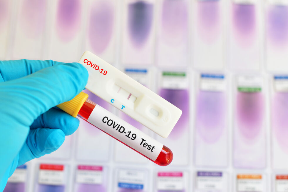 Три нови случая на COVID-19 в Бургаско