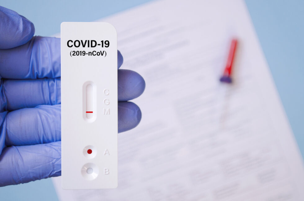 3223 нови случая и 276 починали с COVID-19 у нас