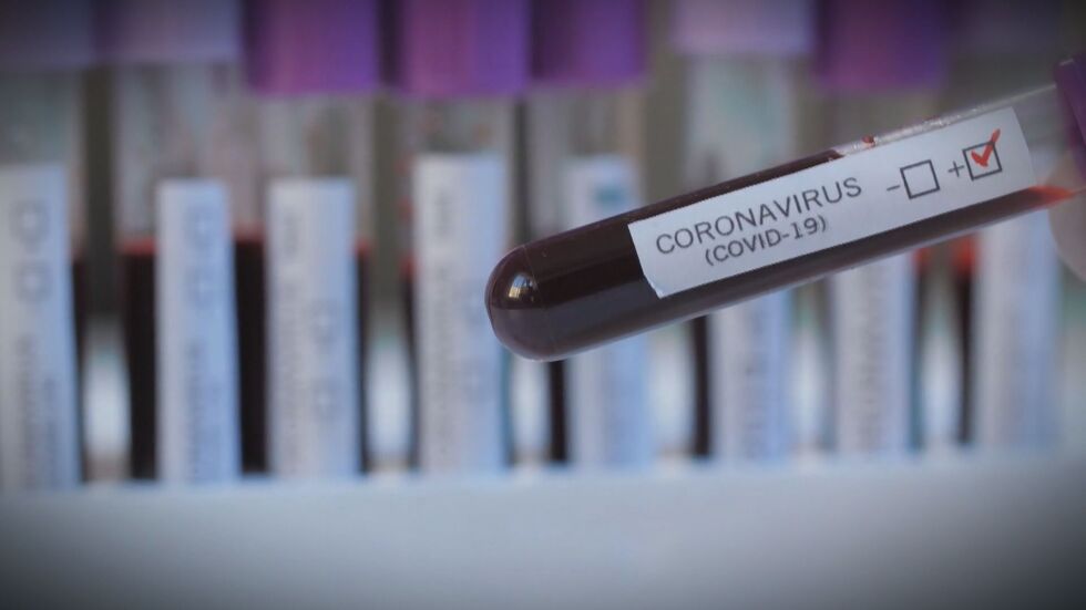 Традиционно нисък брой нови случаи на COVID-19 в неделя – 227