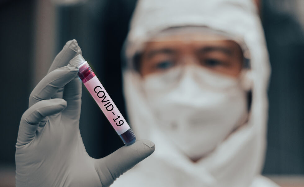 188 са новозаразените с COVID-19 у нас 