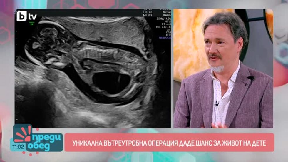 Уникална вътреутробна операция даде шанс за живот на дете