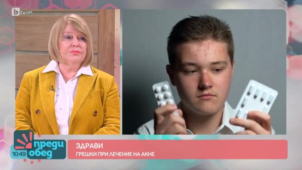 "Здрави": Как с правилна терапия да контролираме акнето?